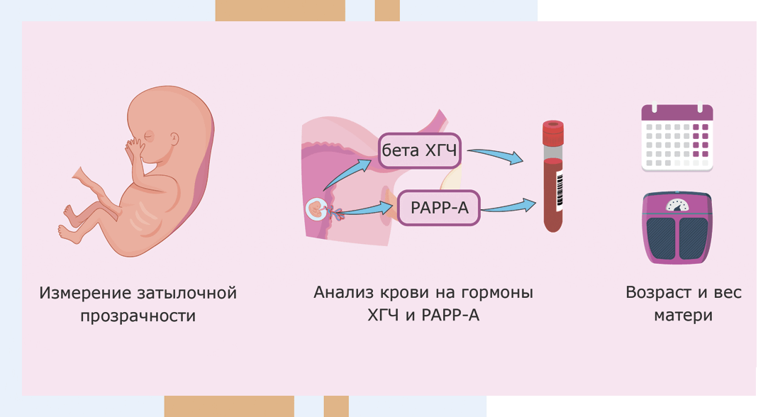 Симптомы синдрома Патау